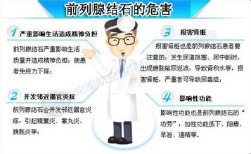 前列腺结石的病因和治疗